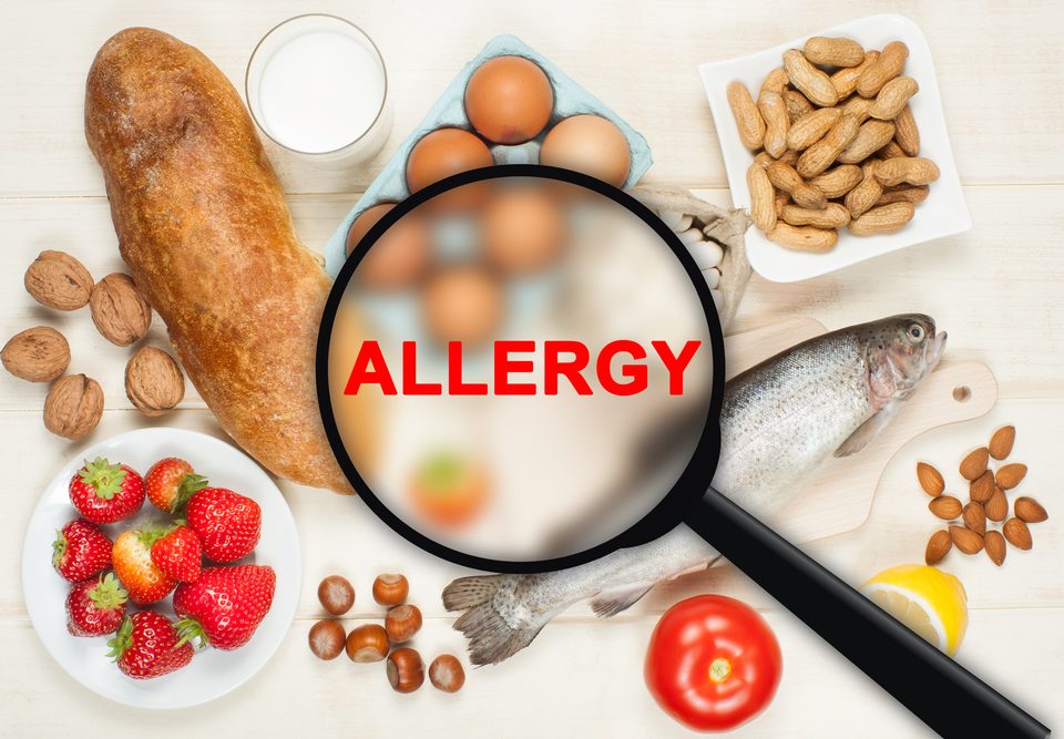 food allergies