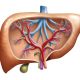 fatty liver