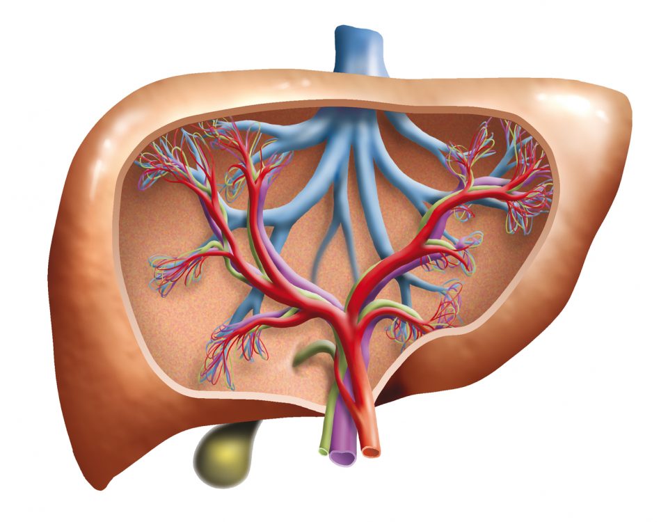 fatty liver