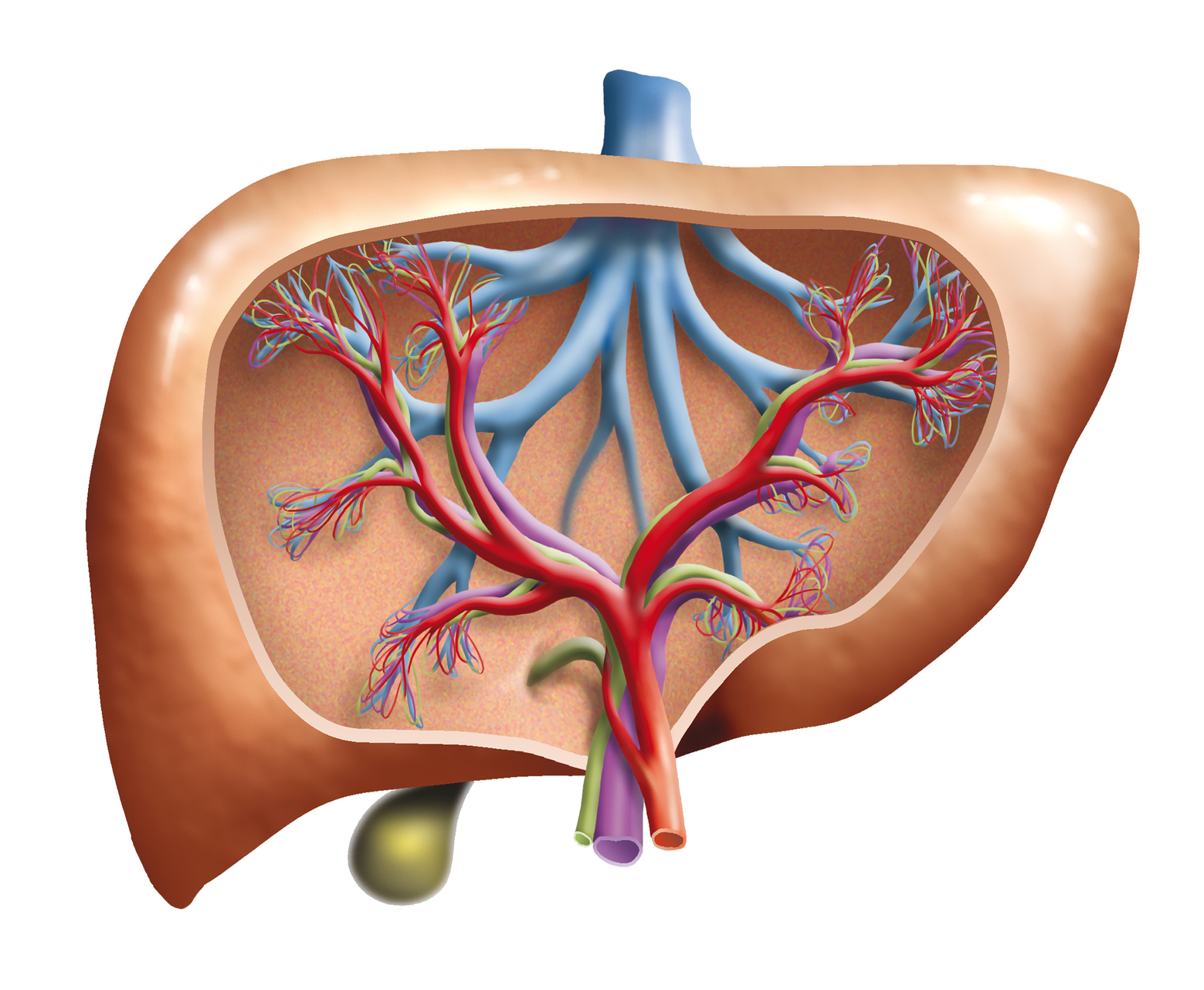 fatty liver