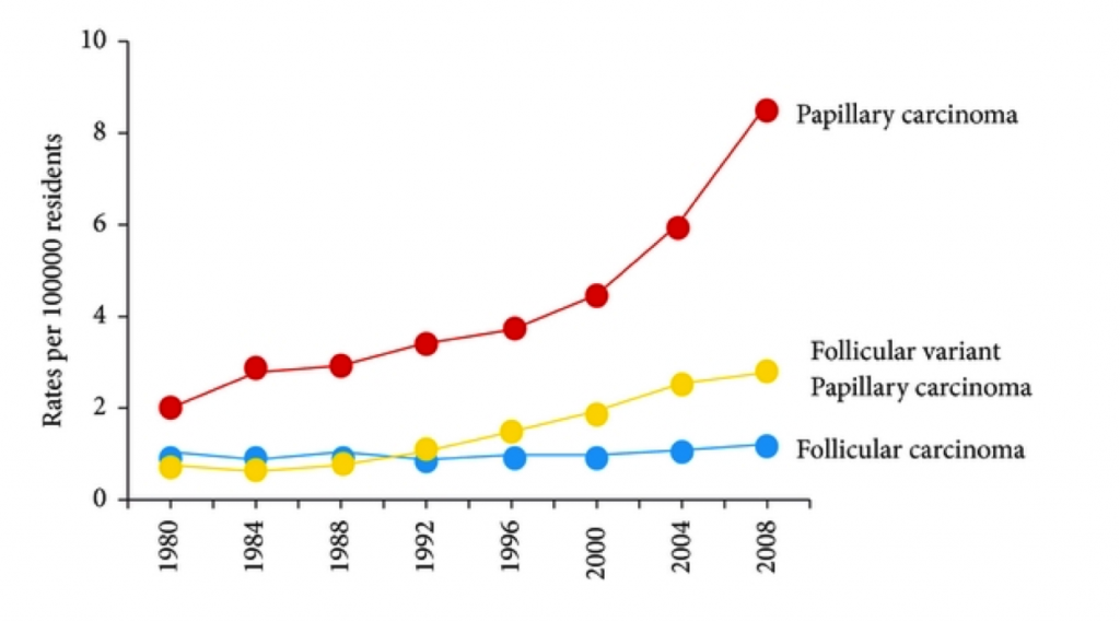 thyroid cancer