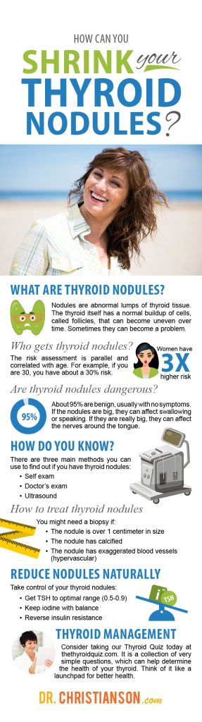 thyroid nodules